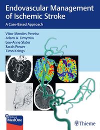Produktbild: Endovascular Management of Ischemic Stroke