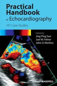 Produktbild: Handbook Echocardiography
