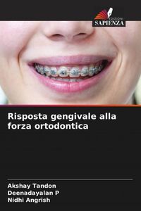 Produktbild: Risposta gengivale alla forza ortodontica