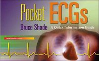 Produktbild: Pocket ECGs: A Quick Information Guide