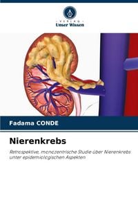 Produktbild: Nierenkrebs