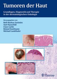 Produktbild: Tumoren der Haut