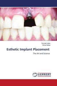Produktbild: Esthetic Implant Placement