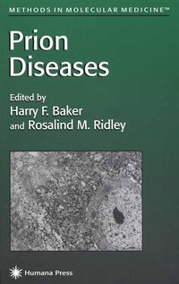Produktbild: Prion Diseases