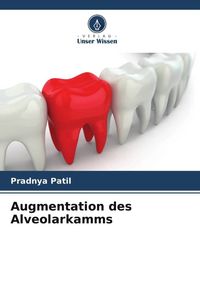 Produktbild: Augmentation des Alveolarkamms