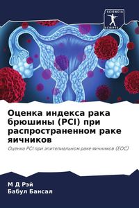 Produktbild: Ocenka indexa raka br&uuml;shiny (PCI) pri rasprostranennom rake qichnikow