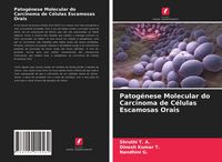 Produktbild: Patog&eacute;nese Molecular do Carcinoma de C&eacute;lulas Escamosas Orais