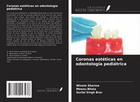 Produktbild: Coronas est&eacute;ticas en odontolog&iacute;a pedi&aacute;trica