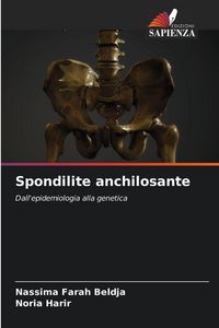 Produktbild: Spondilite anchilosante