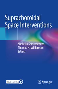 Produktbild: Suprachoroidal Space Interventions