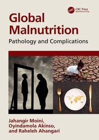 Produktbild: Global Malnutrition