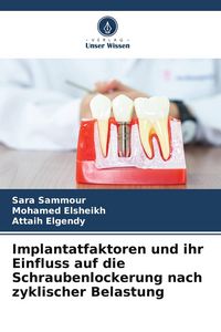Produktbild: Implantatfaktoren und ihr Einfluss auf die Schraubenlockerung nach zyklischer Belastung