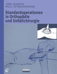 Produktbild: Standardoperationen in Orthop&auml;die und Unfallchirurgie