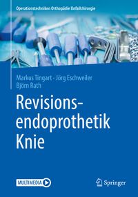 Produktbild: Revisionsendoprothetik Knie
