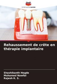 Produktbild: Rehaussement de cr&ecirc;te en th&eacute;rapie implantaire