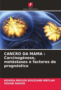 Produktbild: CANCRO DA MAMA : Carcinog&eacute;nese, met&aacute;stases e factores de progn&oacute;stico