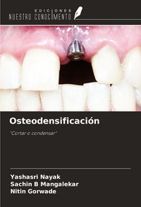 Produktbild: Osteodensificaci&oacute;n