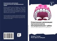 Produktbild: Spontannaq repoziciq patologicheski migrirowawshih zubow
