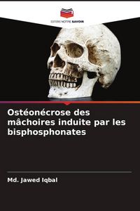 Produktbild: Ost&eacute;on&eacute;crose des m&acirc;choires induite par les bisphosphonates