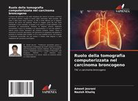 Produktbild: Ruolo della tomografia computerizzata nel carcinoma broncogeno