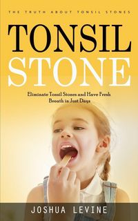 Produktbild: Tonsil Stones