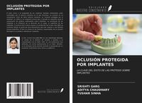 Produktbild: Oclusi&oacute;n Protegida Por Implantes