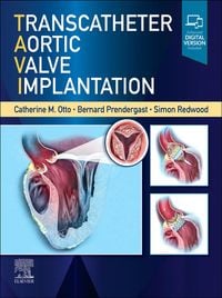 Produktbild: Transcatheter Aortic Valve Implantation, E-Book