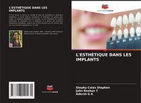 Produktbild: L'esth&eacute;tique Dans Les Implants