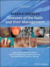 Produktbild: Baran and Dawber's Diseases of the Nails and their Management