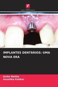 Produktbild: Implantes Dent&aacute;rios: Uma Nova Era
