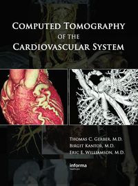 Produktbild: Computed Tomography of the Cardiovascular System