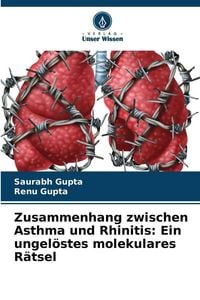 Produktbild: Zusammenhang zwischen Asthma und Rhinitis: Ein ungel&ouml;stes molekulares R&auml;tsel