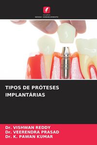 Produktbild: Tipos De Pr&oacute;teses Implant&aacute;rias