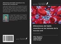 Produktbild: Alteraciones del tejido conectivo en las lesiones de la mucosa oral