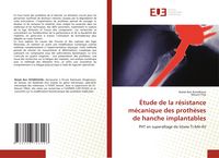 Produktbild: &Eacute;tude de la r&eacute;sistance m&eacute;canique des proth&egrave;ses de hanche implantables