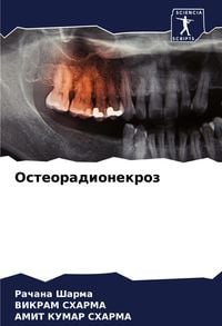Produktbild: Osteoradionekroz