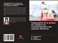 Produktbild: Topographie de la surface de l'implant sur l'ost&eacute;oint&eacute;gration des implants dentaires