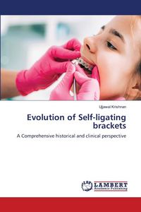 Produktbild: Evolution of Self-ligating brackets