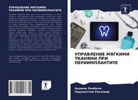 Produktbild: Upravlenie Myagkimi Tkanyami Pri Periimplantite