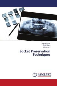Produktbild: Socket Preservation Techniques