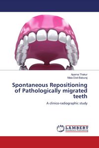 Produktbild: Spontaneous Repositioning of Pathologically migrated teeth