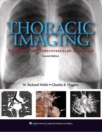 Produktbild: Thoracic Imaging 2/e