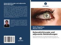 Produktbild: Kataraktchirurgie und adjuvante Behandlungen