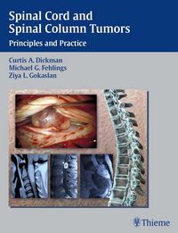 Produktbild: Spinal Cord and Spinal Column Tumors