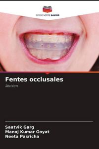 Produktbild: Fentes occlusales