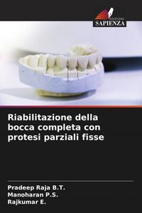 Produktbild: Riabilitazione della bocca completa con protesi parziali fisse