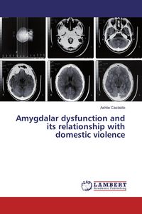 Produktbild: Amygdalar dysfunction and its relationship with domestic violence