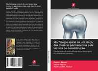 Produktbild: Morfologia apical de um ter&ccedil;o dos molares permanentes pela t&eacute;cnica de desobstru&ccedil;&atilde;o