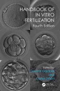 Produktbild: Handbook of In Vitro Fertilization