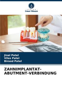Produktbild: Zahnimplantat-Abutment-Verbindung